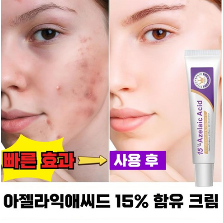 함익병 동아제약 멜라논 크림  효능